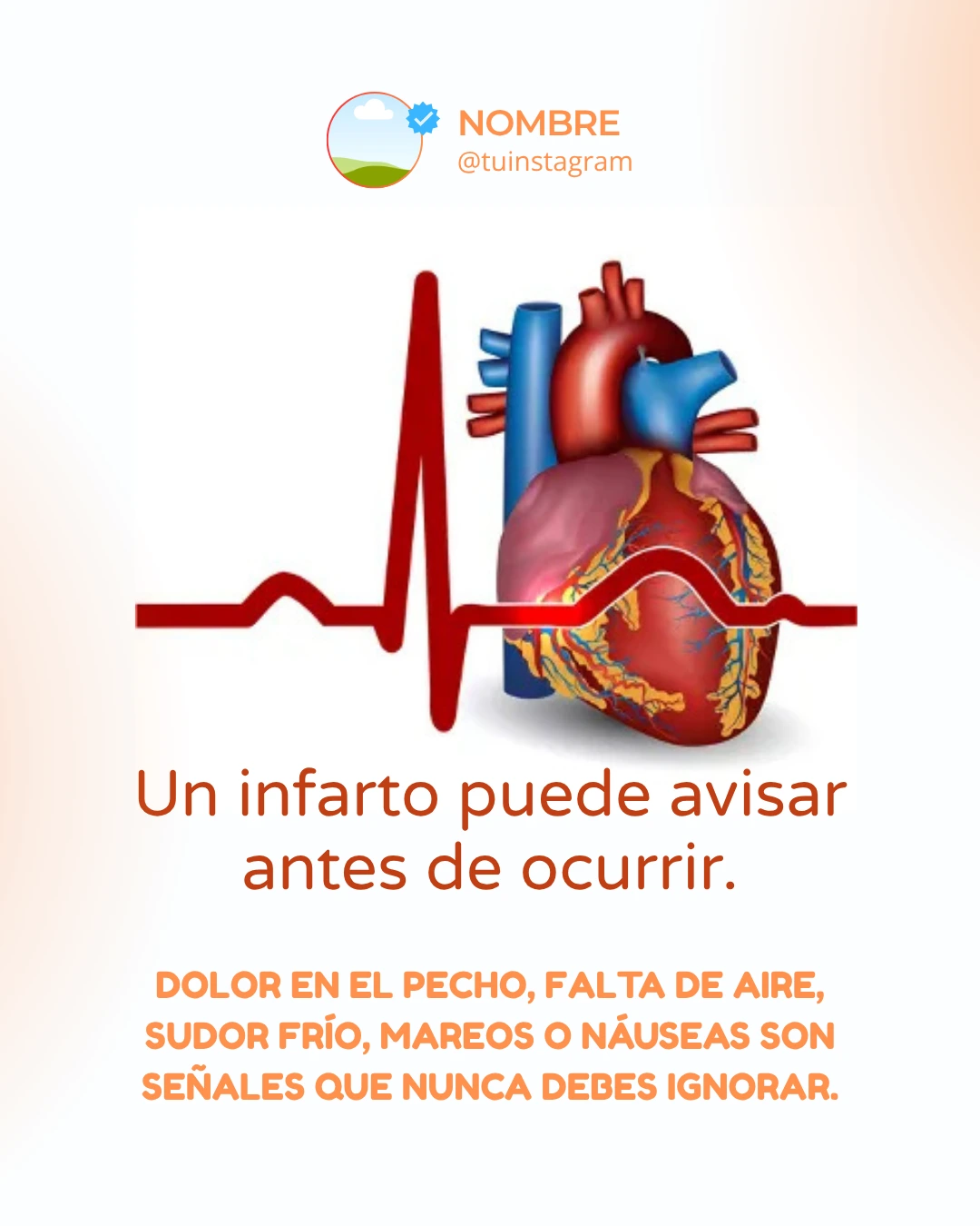 Plantilla feed